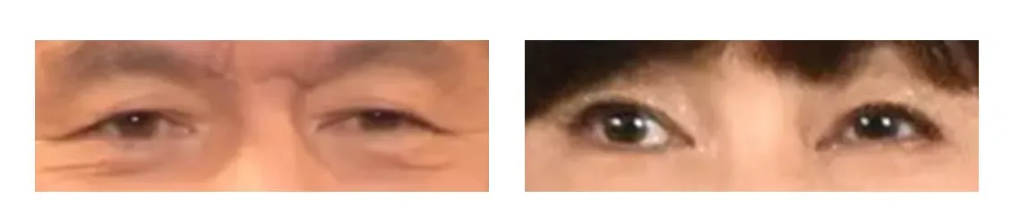 ヒロミさん夫妻の目元を並べて比べた画像